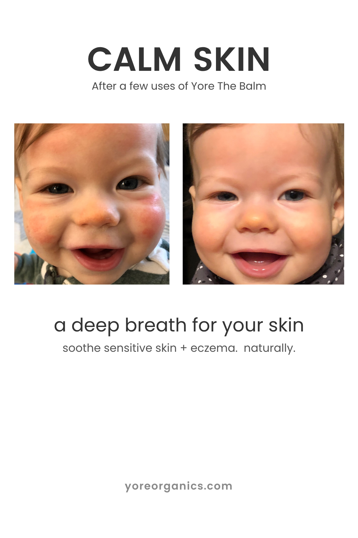 Yore THE Balm (WS)